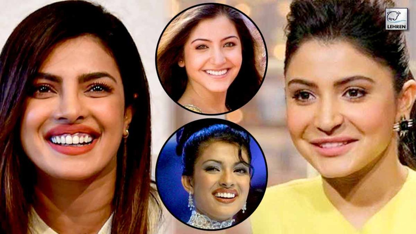 Bollywood’s Biggest Cosmetic Surgery Disasters